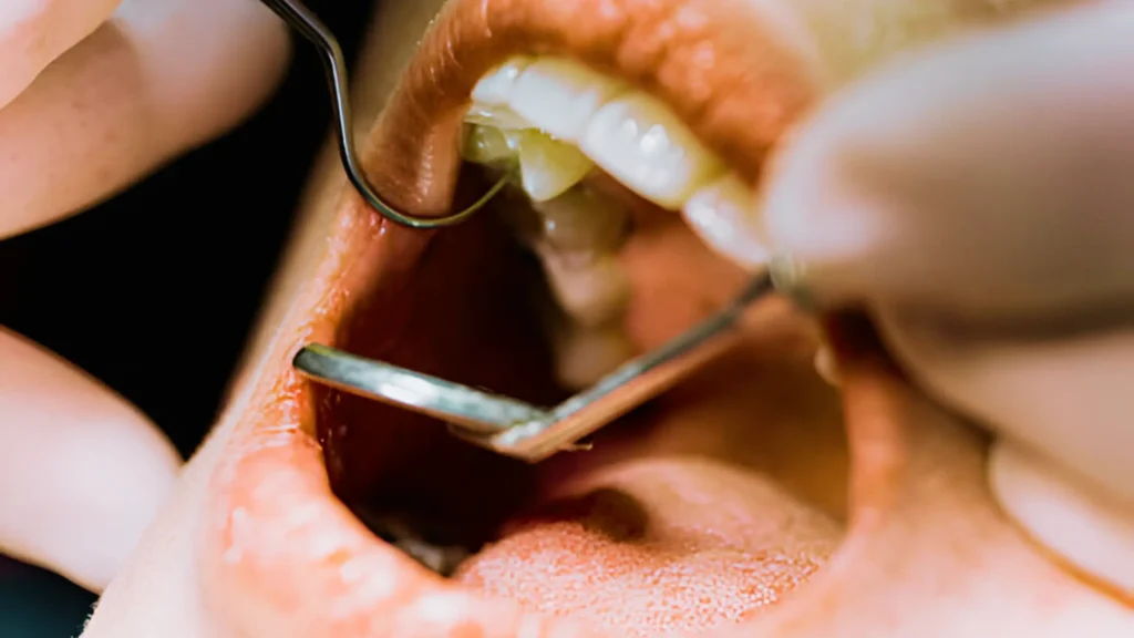 Endodontics in Thalassery