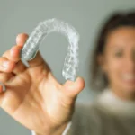 Clear Aligner Treatment Journey