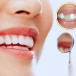 Smile Makeover Before & After