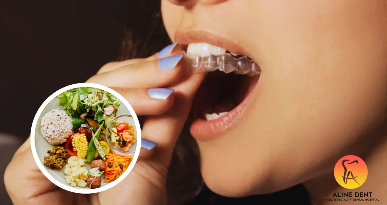 foods to eat with clear aligners