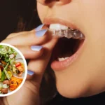 foods to eat with clear aligners