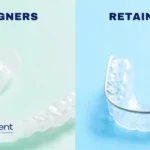 Aligners vs Retainers difference