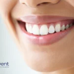 How to Whiten Teeth Naturally