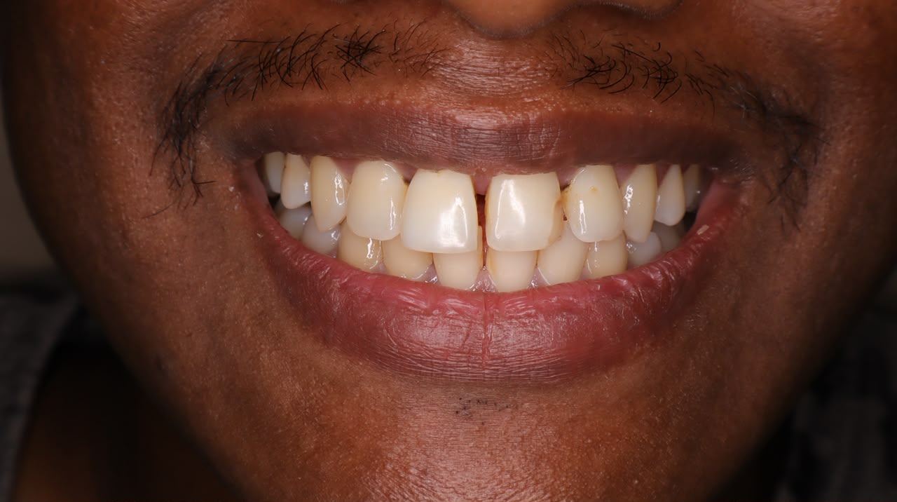 Before treatment