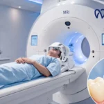 Can MRI Be Done With Dental Crowns