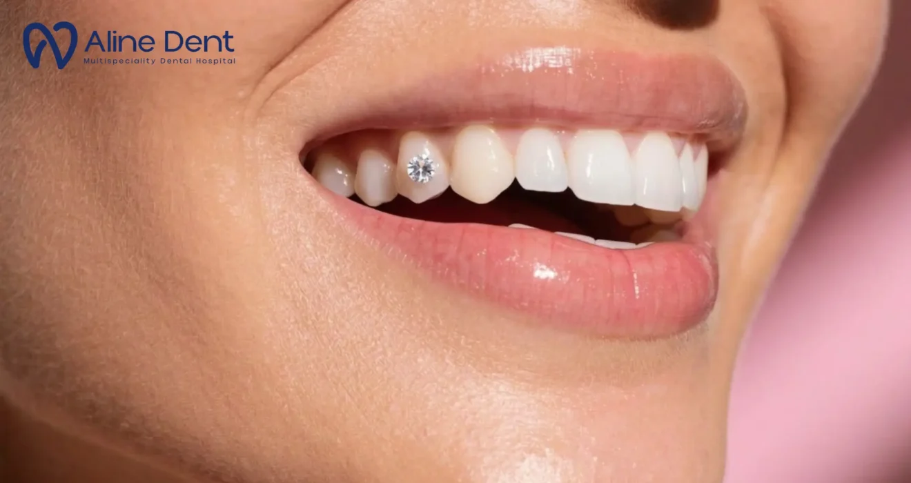 Are Tooth Gems Safe