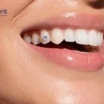 Are Tooth Gems Safe