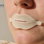 Mouth Taping Trend