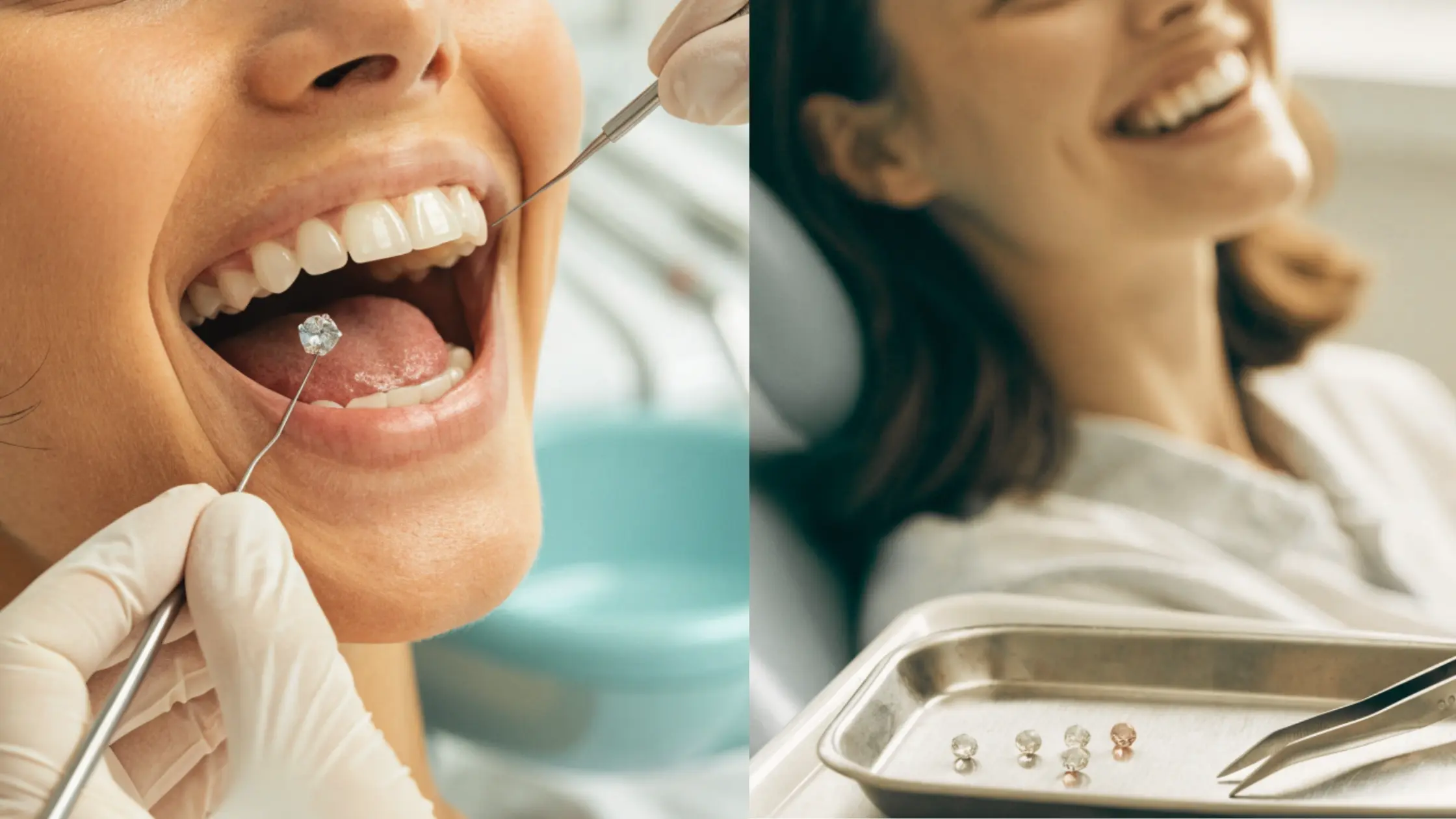 Tooth Gems Removal